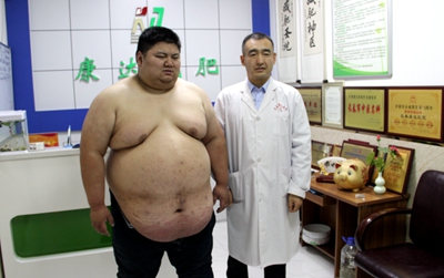 27岁男子在长春康达两个月减近80斤,重度睡眠呼吸暂停低通气综合征得到缓解1.jpg