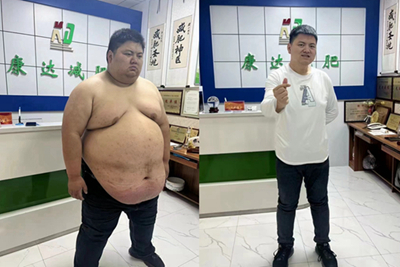 贾玲减肥100斤！“整容式”暴瘦靠谱吗？年前还能暴瘦吗？.jpg