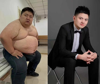肥胖是打鼾的常见诱因，长春康达减肥：减重是减轻症状的重要手段1.jpg