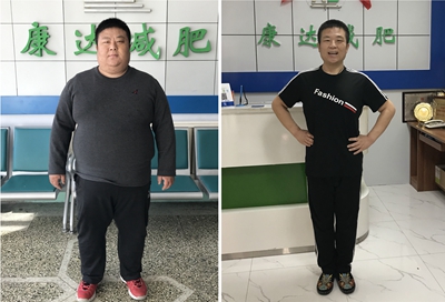 肥胖是打鼾的常见诱因，长春康达减肥：减重是减轻症状的重要手段2.jpg