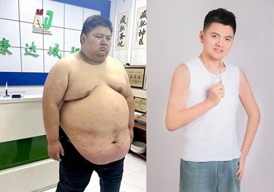 减重药近40%体重减轻来自肌肉!长春康达提醒2.jpg